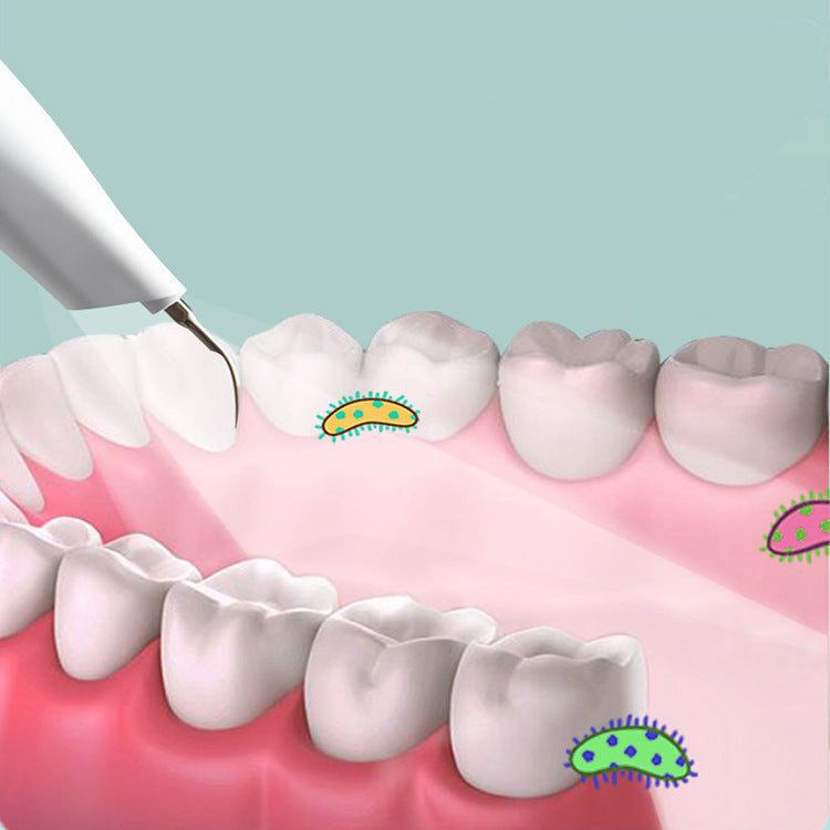 Ultrasonic Dental Cleaner