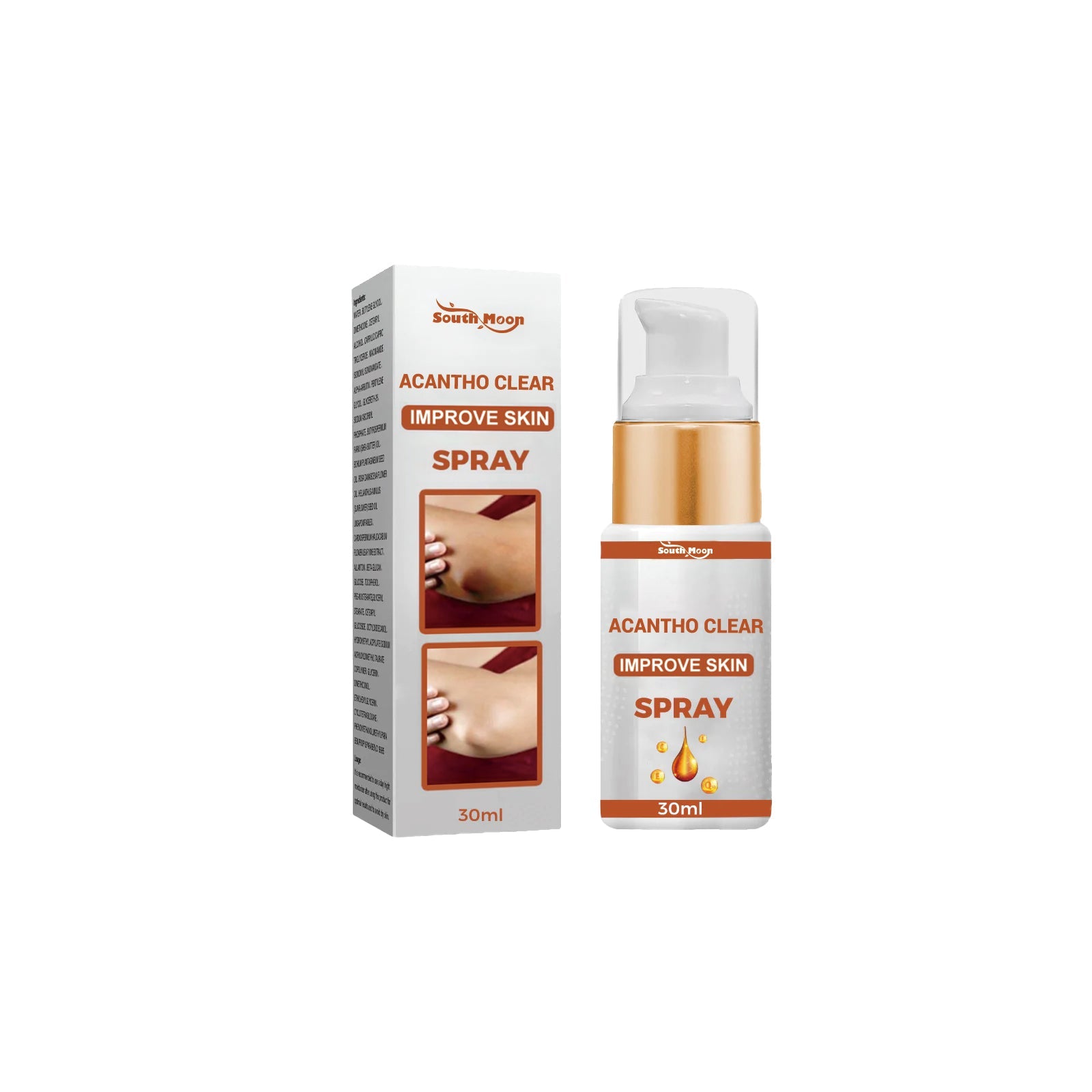 Acantho Clear Improve Skin Spray, Repair Black Spot, Elbow Knee Joint Black Whitening Skin Spray