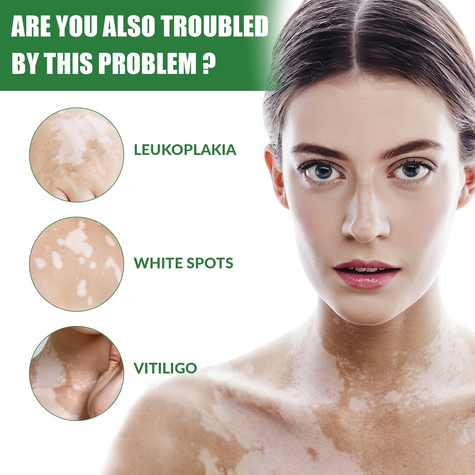 White Spot Repair Cream Skin White Spot Melanin Repair Even Skin Tone Topical Care Cream