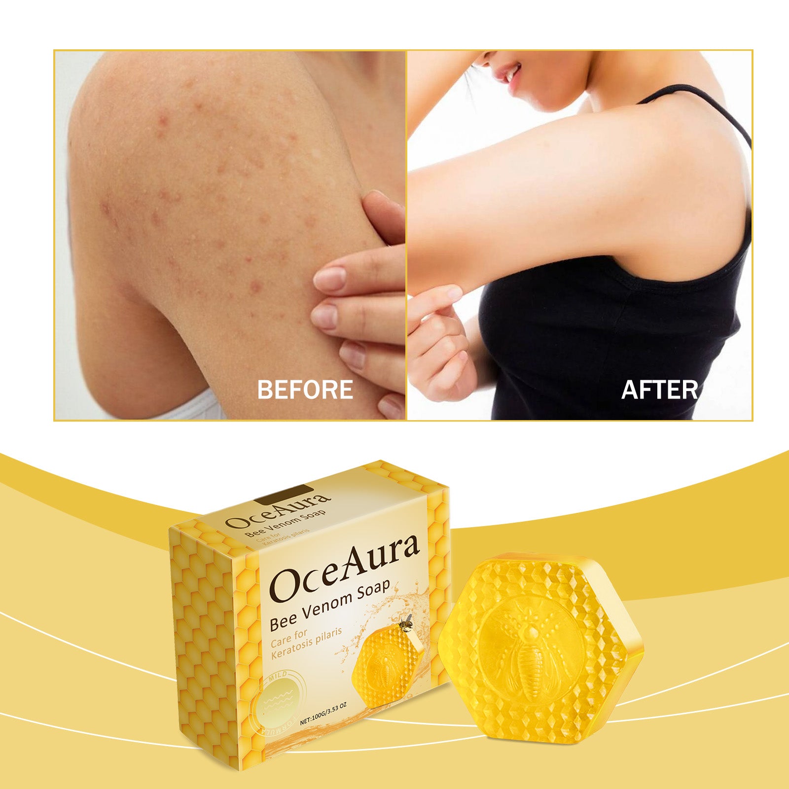 Oceaura Bee Venom Soap For Deep Body Cleansing, Moisturizing, Brightening And Improving Skin And Bathing Body Soap