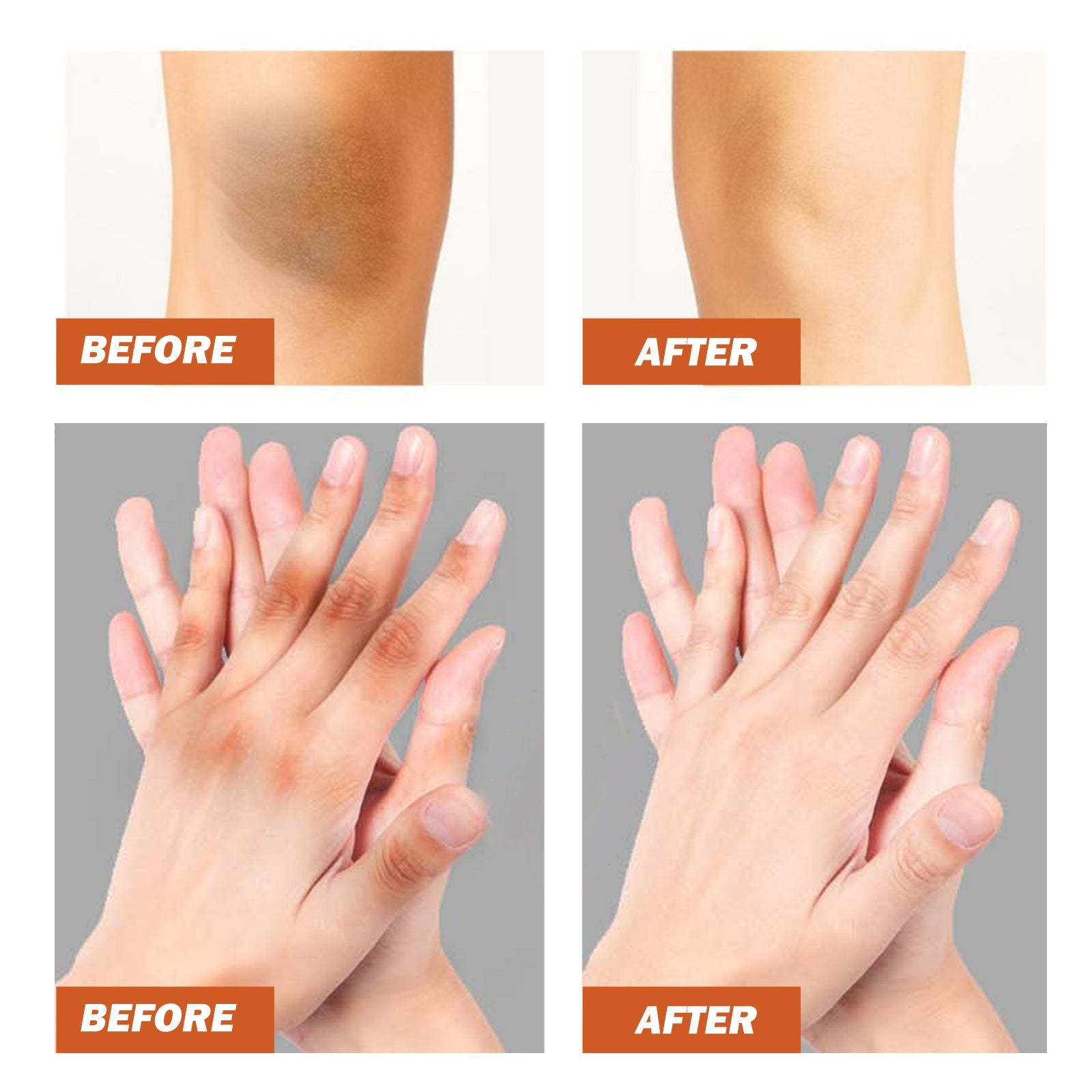 Black Wattle Essential Oil, Repair Underarm Joint Black Whitening Skin Light Spots Skin Beauty Essence Oil