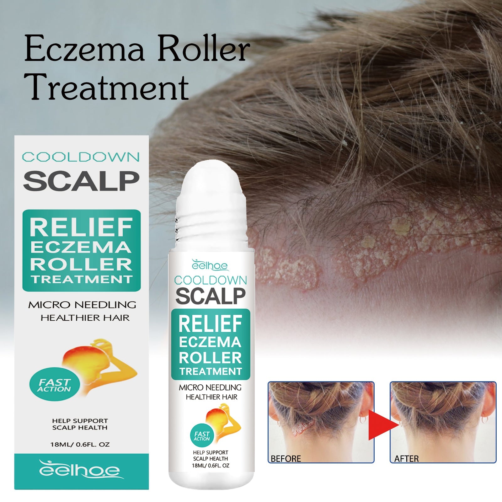 Scalp Care Ball, Repair Skin Moss Scalp Moss Deep Clean And Moisturizing Scalp Care Ball
