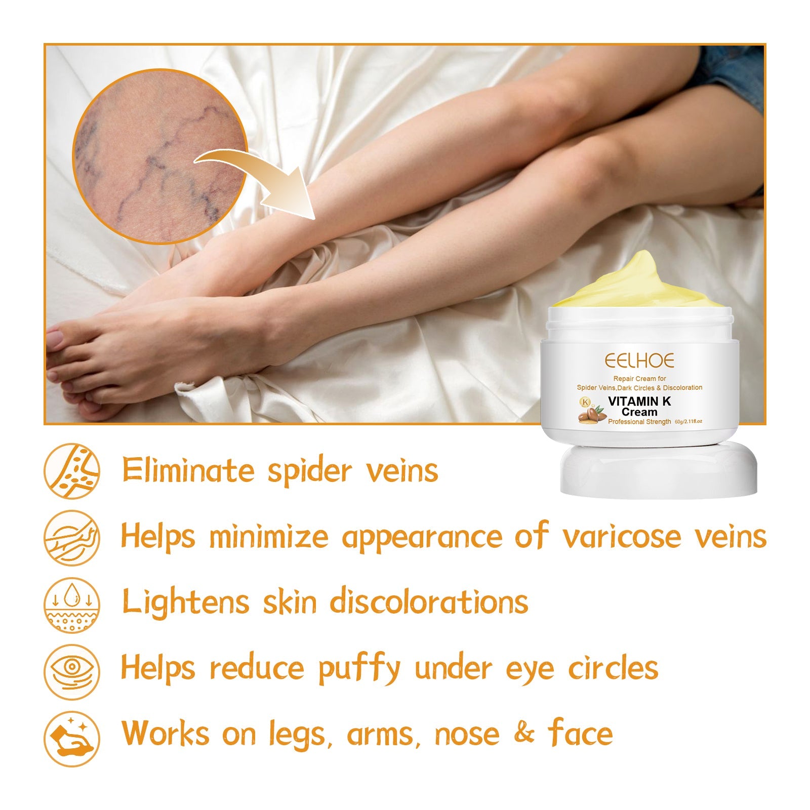 Vitamin K Varicose Vein Leg Cream