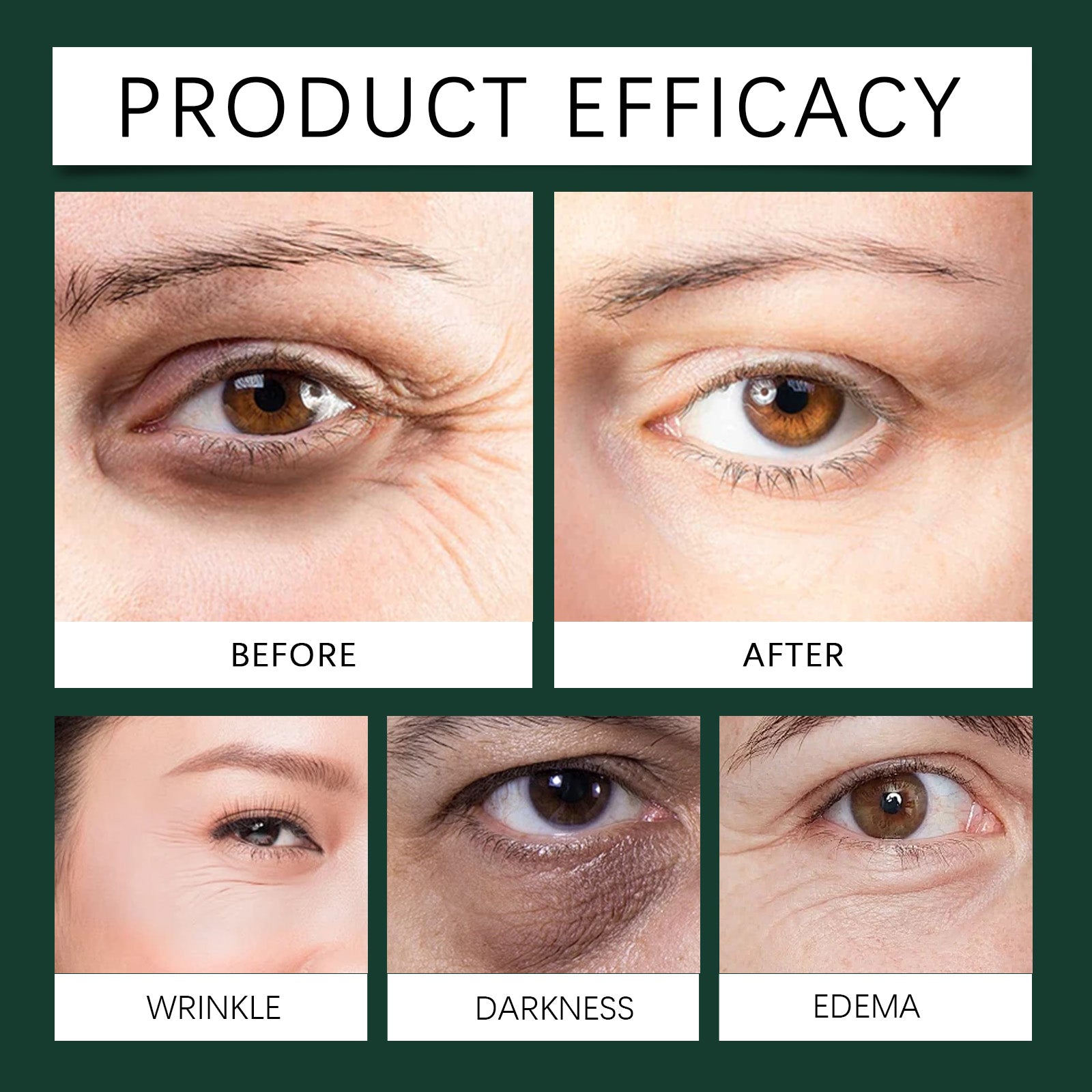 Mint Essence Eye Roller, Fade Fine Lines Crow&