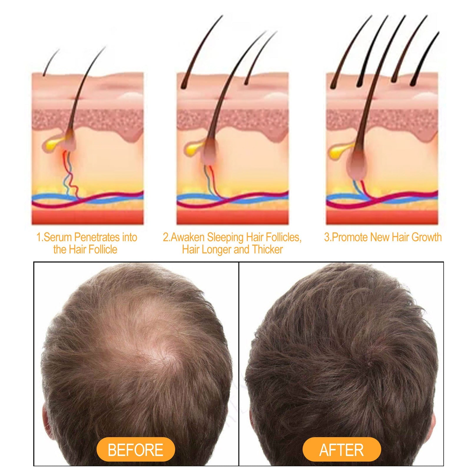 Ginger Juice Moisturizes Hair, Moisturizing And Repairing Hair Follicle Hair Strong Anti-Shampoos