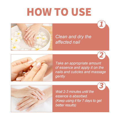 7 Day Nail Repair Essence, Hand And Foot Gray Nail Brightening Soft Nail Thickening Toenail Care Solution