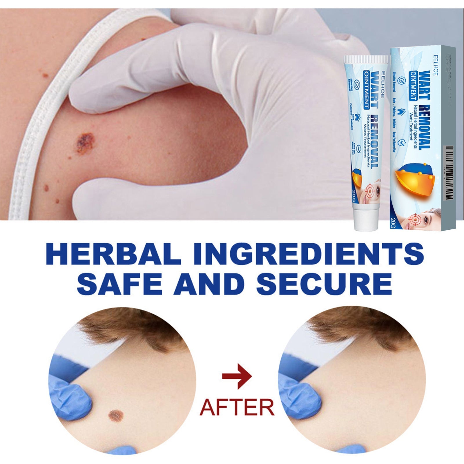 Keyu Cream Clean Skin Repair Care Body Face Remove Face Label Keyu Cream