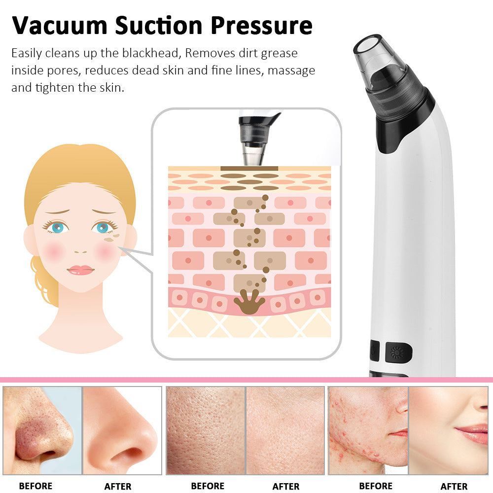 Heating Blackhead Pore Vacuum
