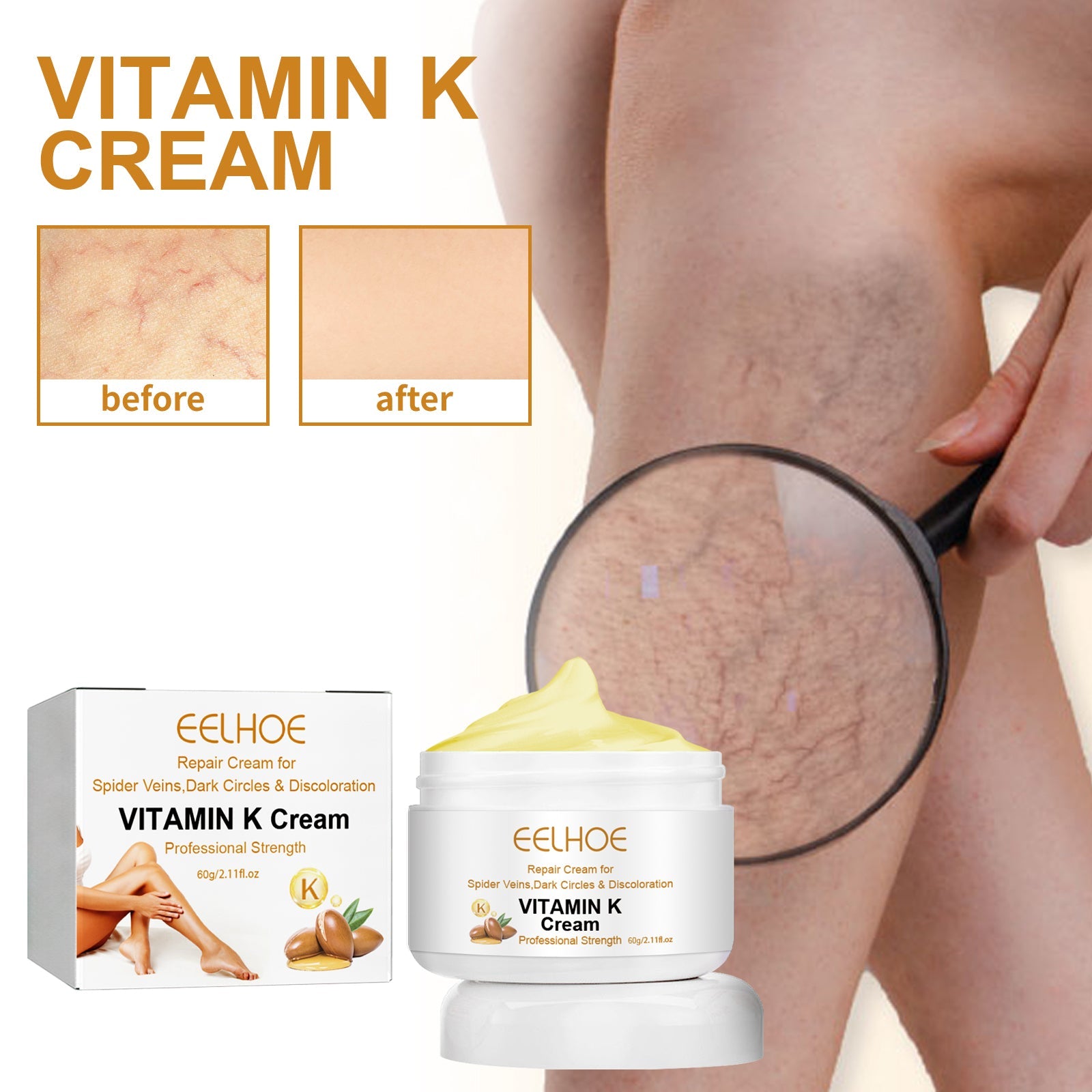 Vitamin K Varicose Vein Leg Cream
