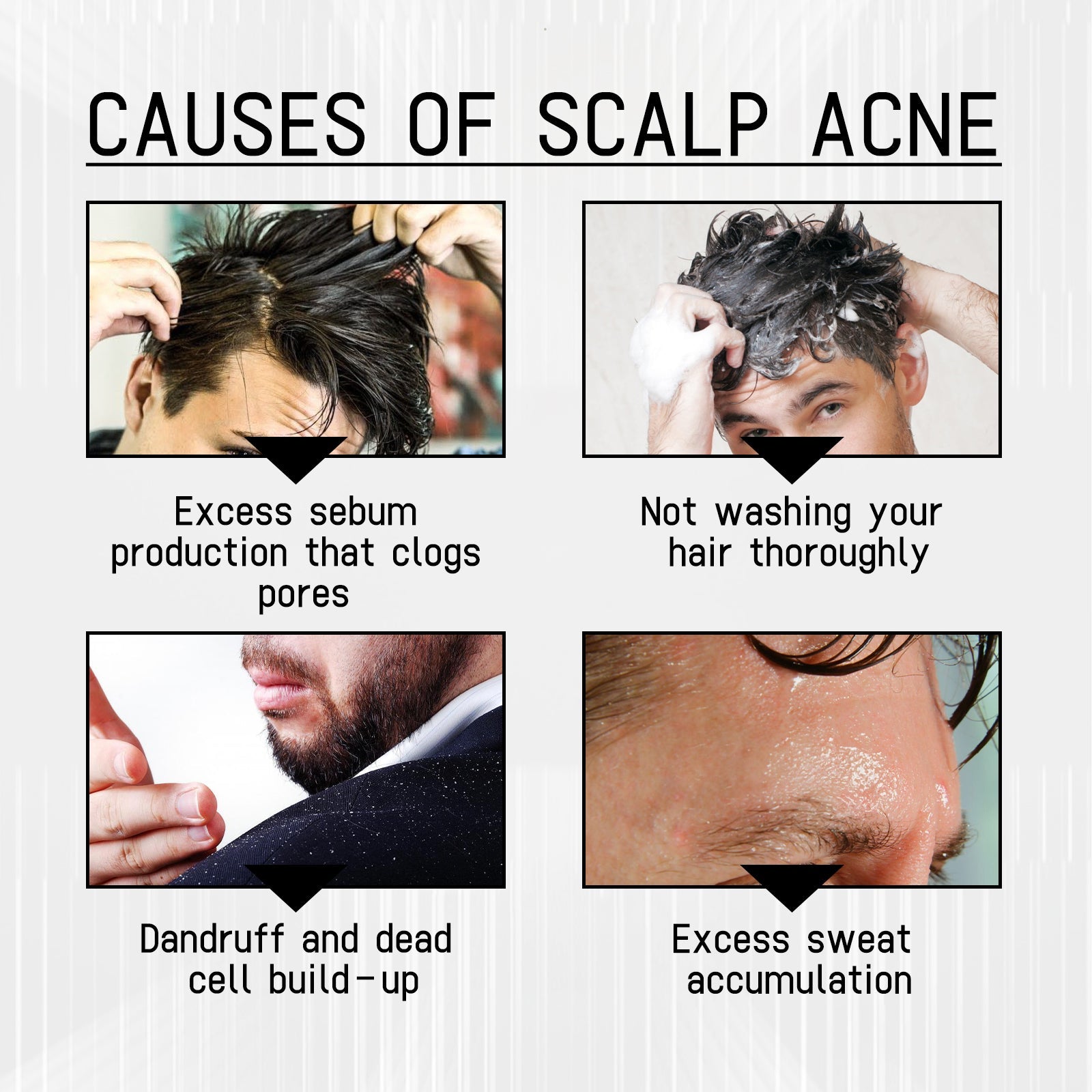 West &amp; Month Anti-Shedding Hair Spray, Improve The Hairline Hair Hair Nutrition Moisture Hair Roots