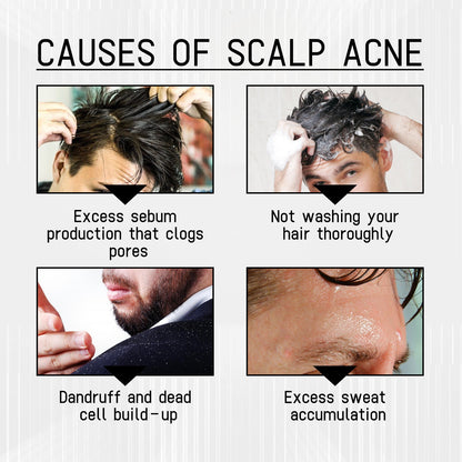 West &amp; Month Anti-Shedding Hair Spray, Improve The Hairline Hair Hair Nutrition Moisture Hair Roots