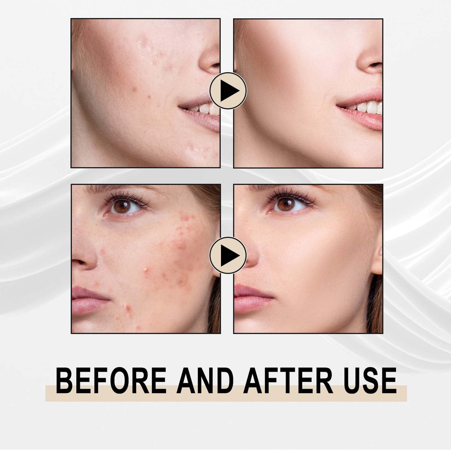 Lactose Solution, Exfoliate Remove Blackheads Shrink Pores Clean And Moisturize SkinEssence