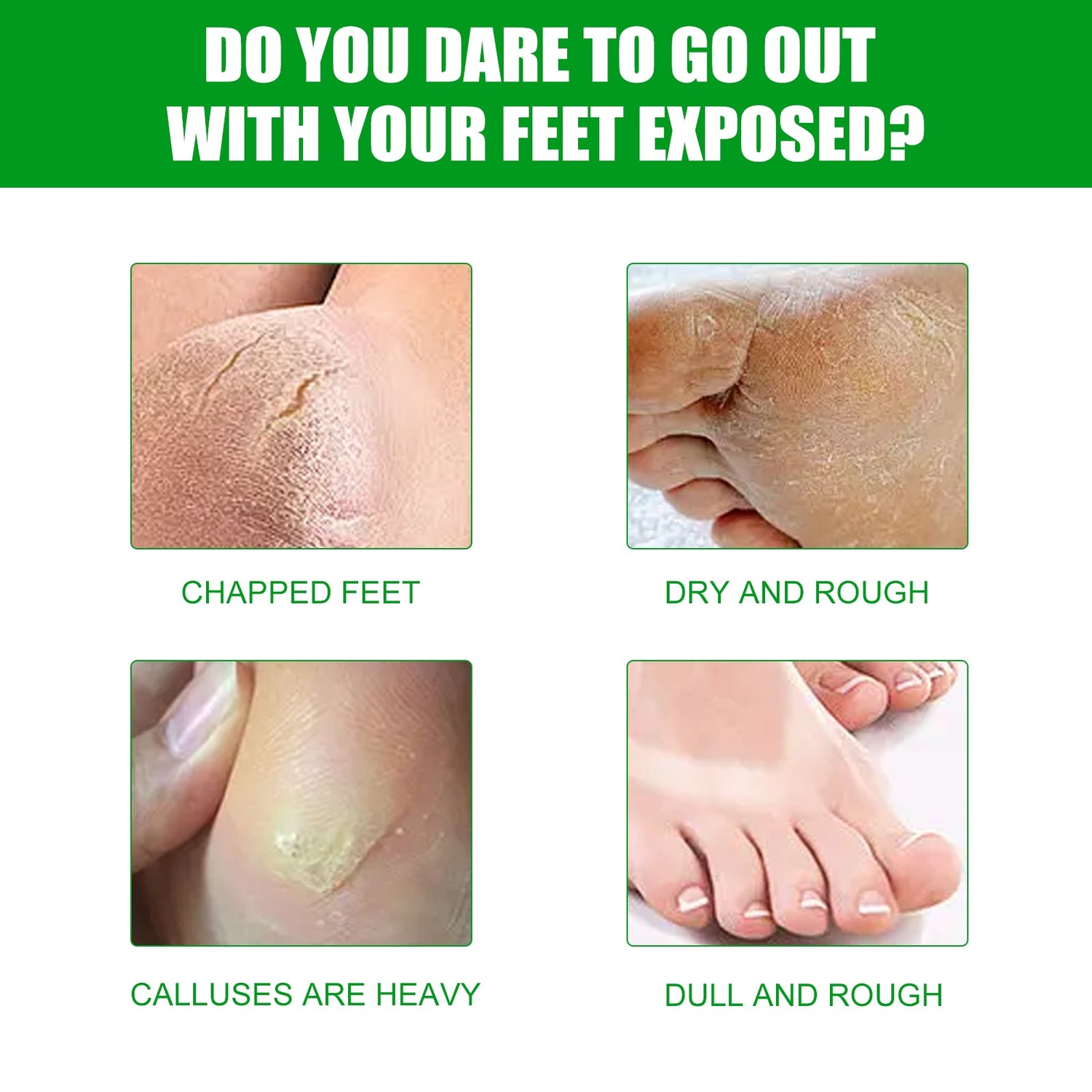 Aloe Vera Foot Mask, Moisturizing Anti-Cracking, Dead Skin Removal, Tender Skin Care Foot Mask