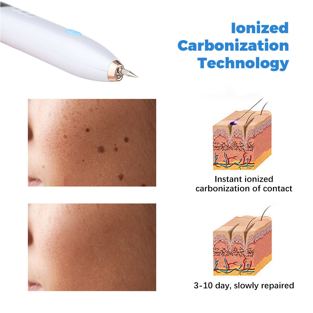 9-Speed Laser Mole Removal Pen