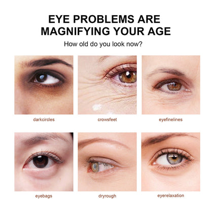 Snake Venom Eye Cream, Firming Eye Bags Hydrating And Reducing Fine Lines Eye Care Eye Cream