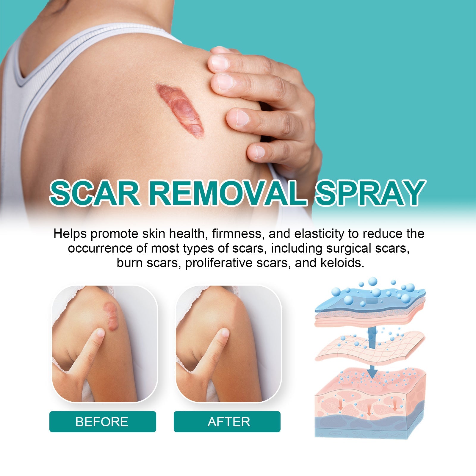 Skin Care Spray Smooth Skin Care Spray Moisturizes Skin Smooth And Radiant Spray