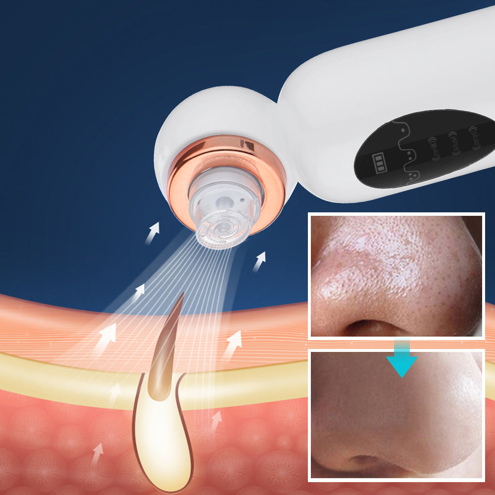 3-Speed Small Bubble Blackhead Instrument Facial Pore Cleaning To Remove Blackhead Beauty Instrument Electric Blackhead Exporter