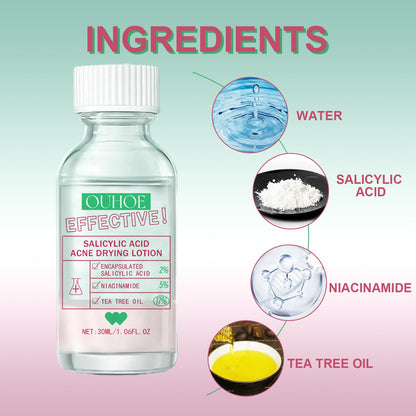 Salicylic Acid Acne Drying Lotion, Gentle Repair Acne-Skin Skin Moisturizing Lotion