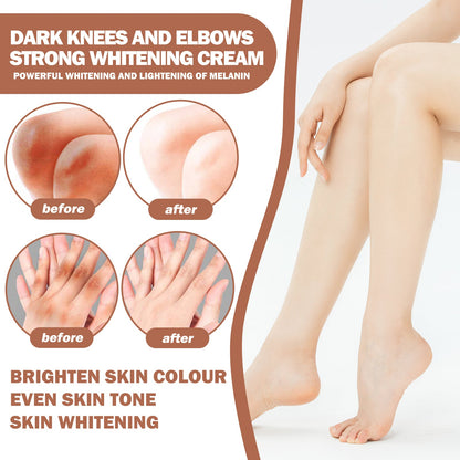 Joint Whitening Cream, Moisturizes Dull Skin Whitening Repair Cream For Joints And Elbows
