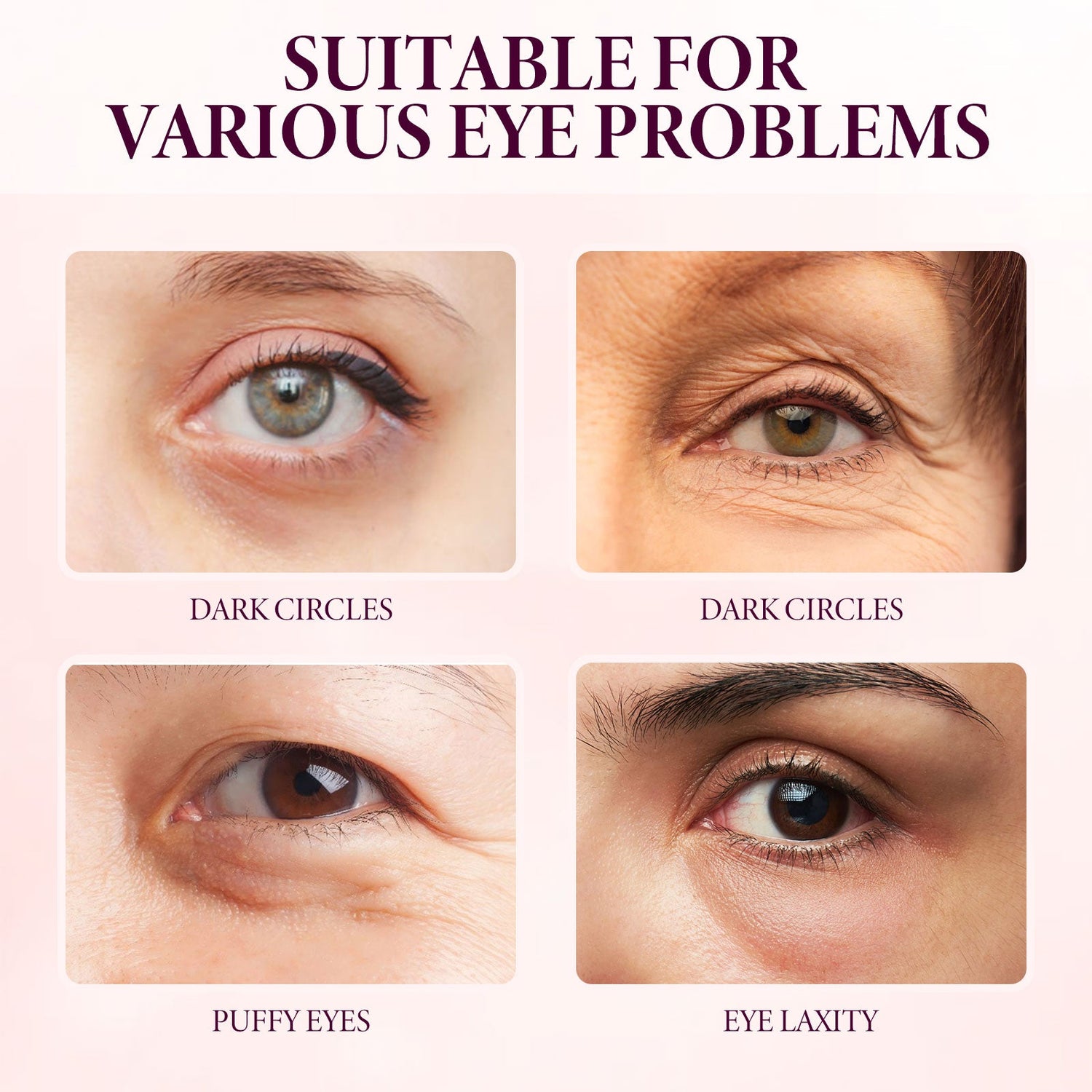Mango Eye Cream Reduces Fine Lines Of Crow&