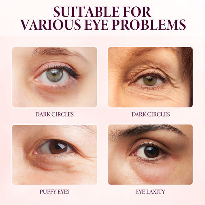 Mango Eye Cream Reduces Fine Lines Of Crow&