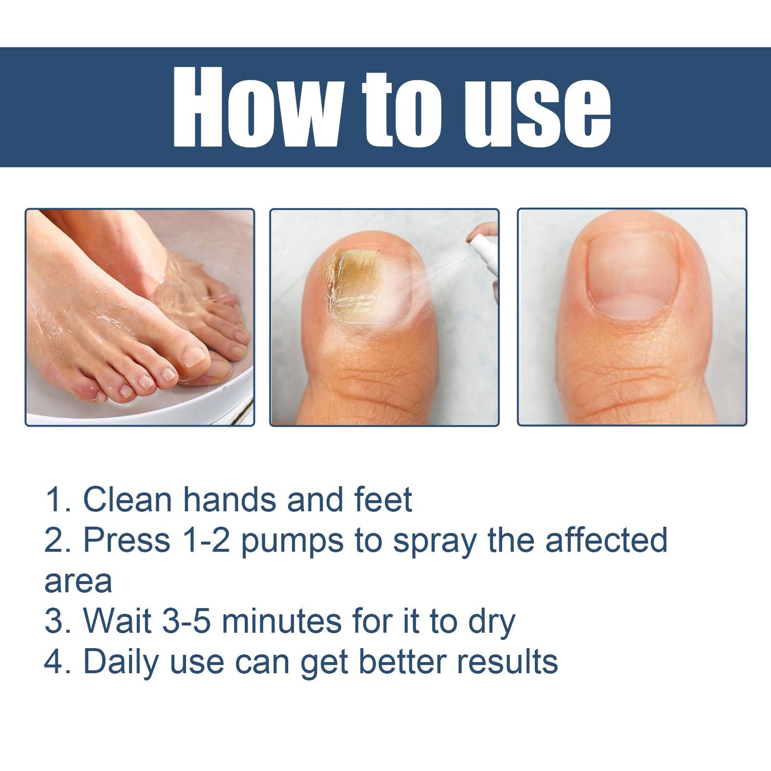 Nail Care Spray Gently Cleans Foot Nails Moisturizing And Brightening Nail Care Spray