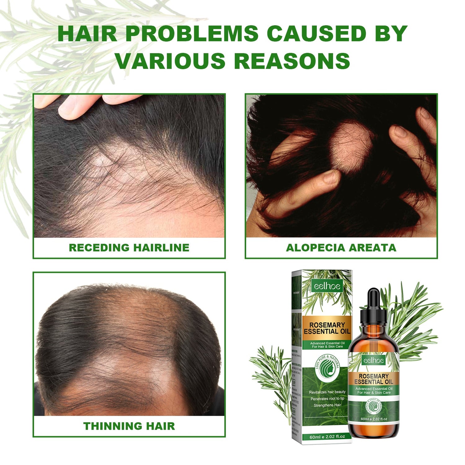 Rosemary Essential Oil Hydrates And Moisturizes Damaged Hair, Strengthens Hair And Softens Hair Care Essential Oil