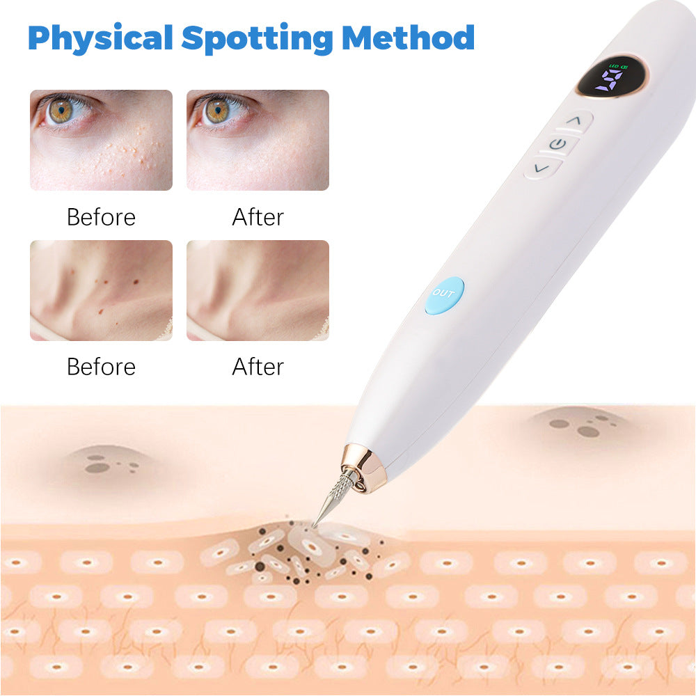 9-Speed Laser Mole Removal Pen