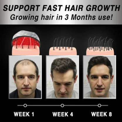 Moving Hair Growth Treatment, Repair Frizzy, Smooth And Dense Hair Scalp Care Heating Massage Cap