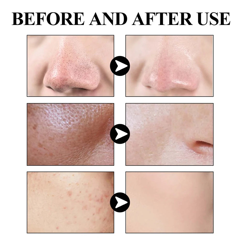 West &amp; Month Blackhead Remove Solid Mud Film Refreshing Skin Cleaning Face Mask Moisturize Control Oil Shrink Pores Skin Care