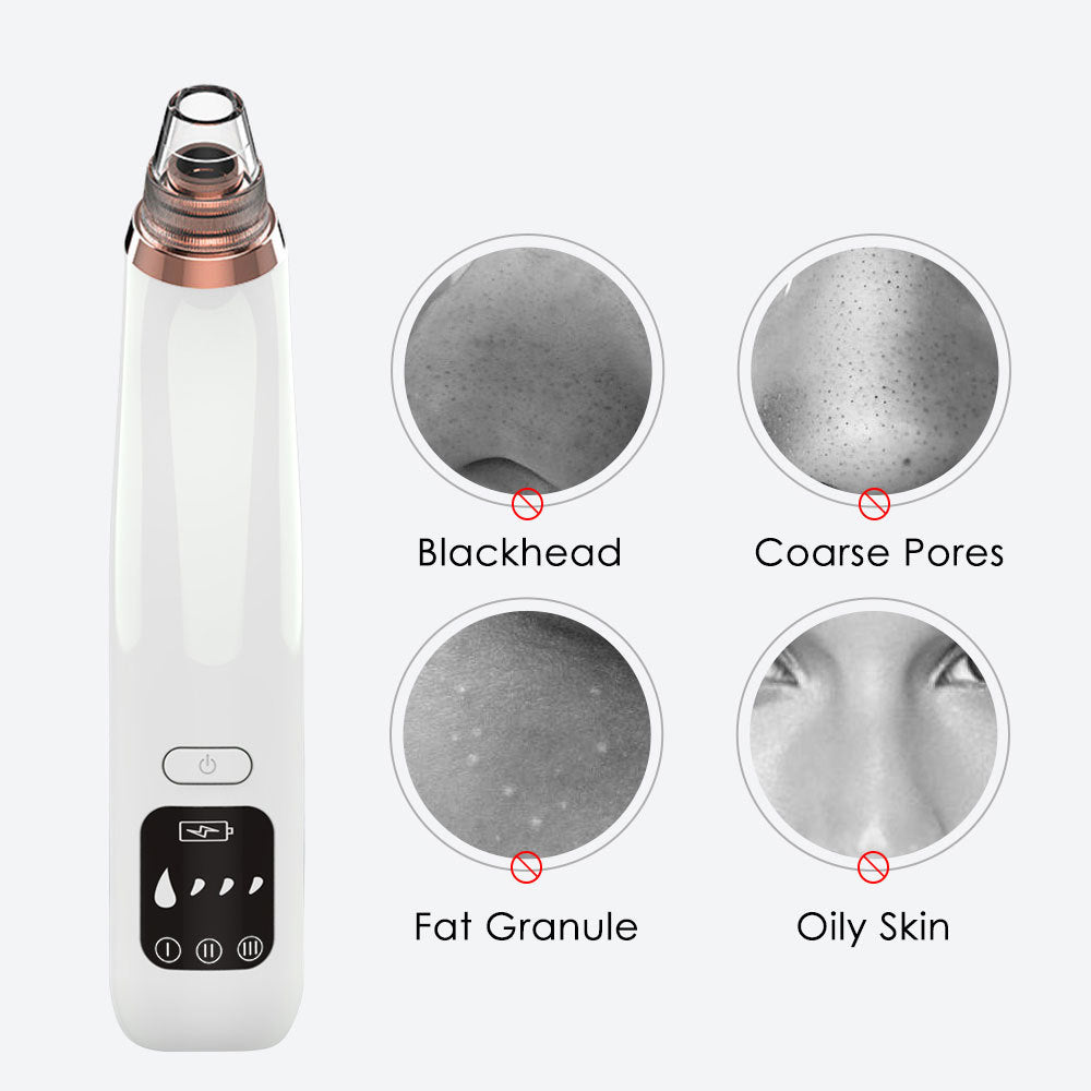 Hot Compress Blackhead Cleaner
