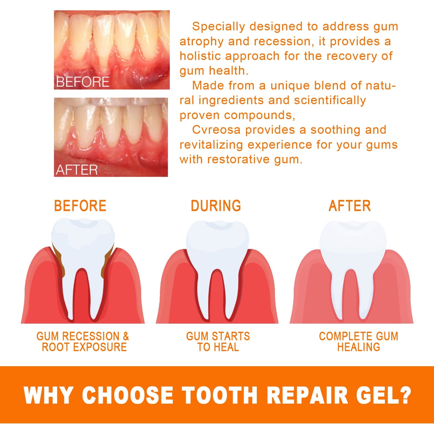 Tooth Repair Essence, Cleaning Teeth Stains Tartar Care Gums Oral Care Essence