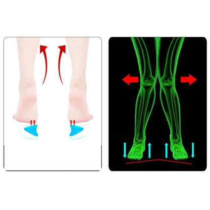 Flatfoot Gel Arch Support Insoles