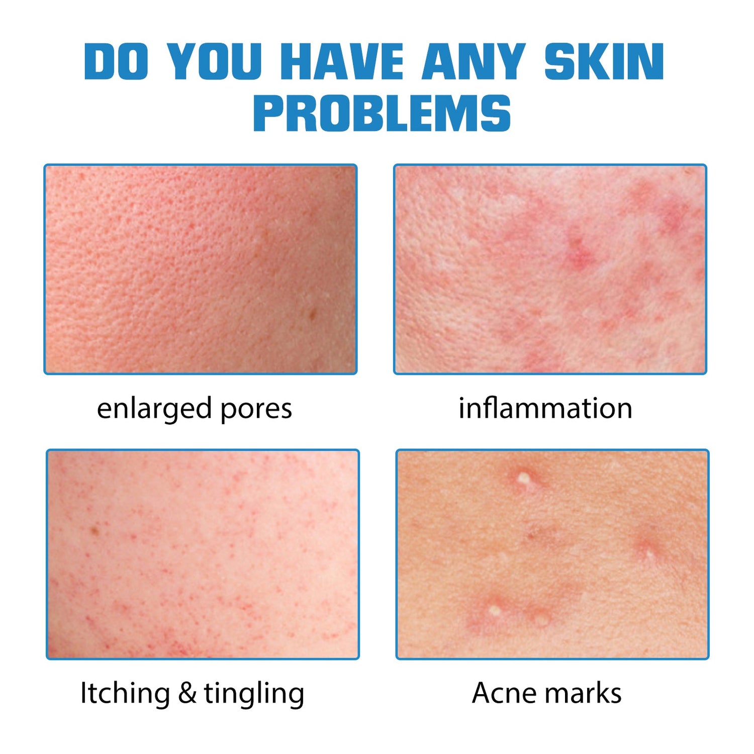Hyaluronic Acid Face Serum, Moisturizing Repair Lighten Acne Mark Skin Care Whitening Essence