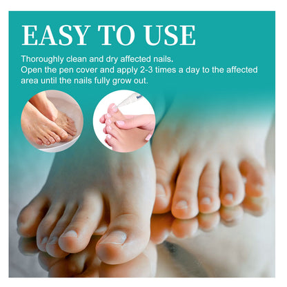Nail Repair Pen, Repair Hands And Feet Gray Nails Brightening Nails Soft Nails Thickening Nails Moisturizing Care