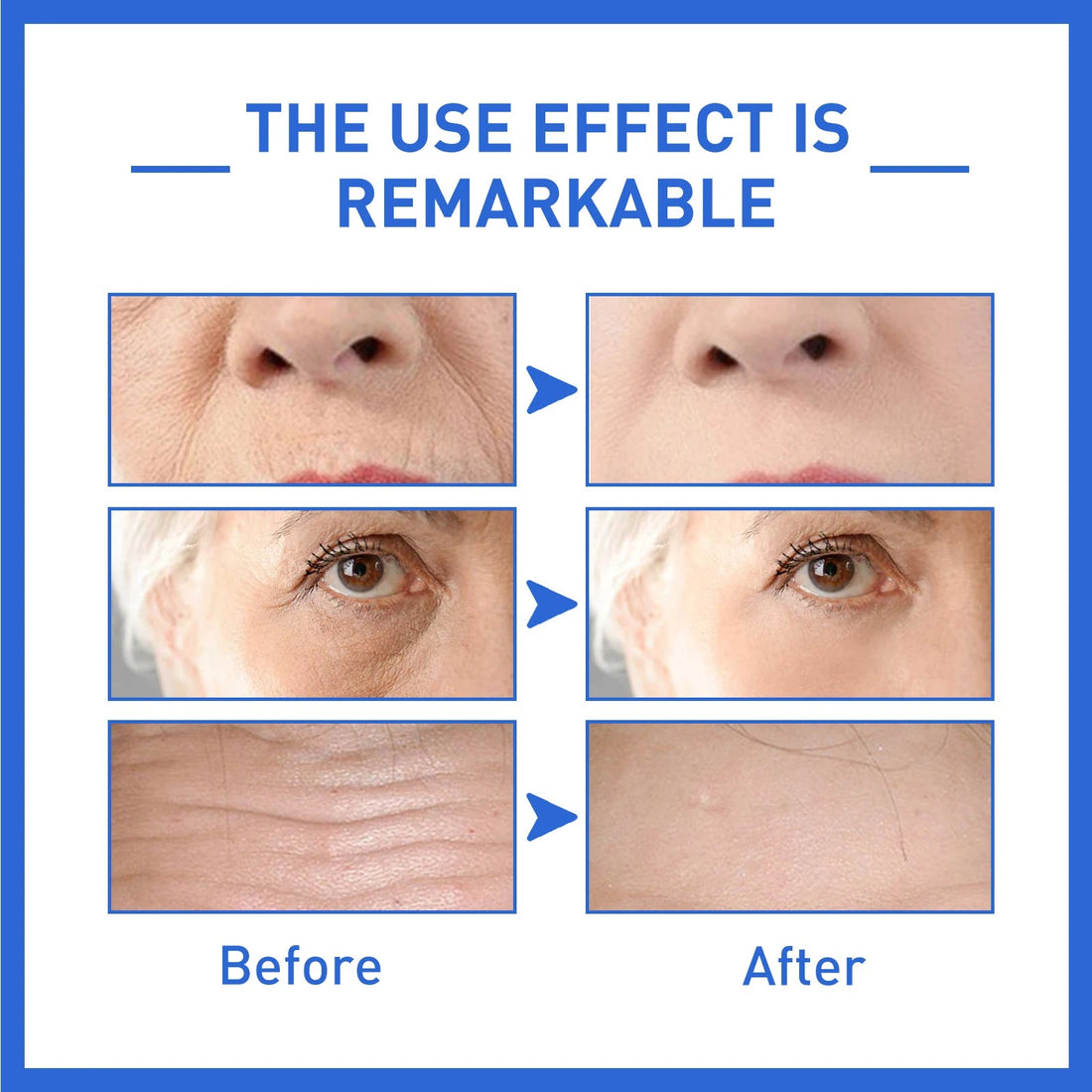 Anti-Aging Collagen Serum with Nicotinamide, Vitamin C, Hyaluronic Acid - Reduce Dark Spots, Cleanse &amp; Tighten Skin