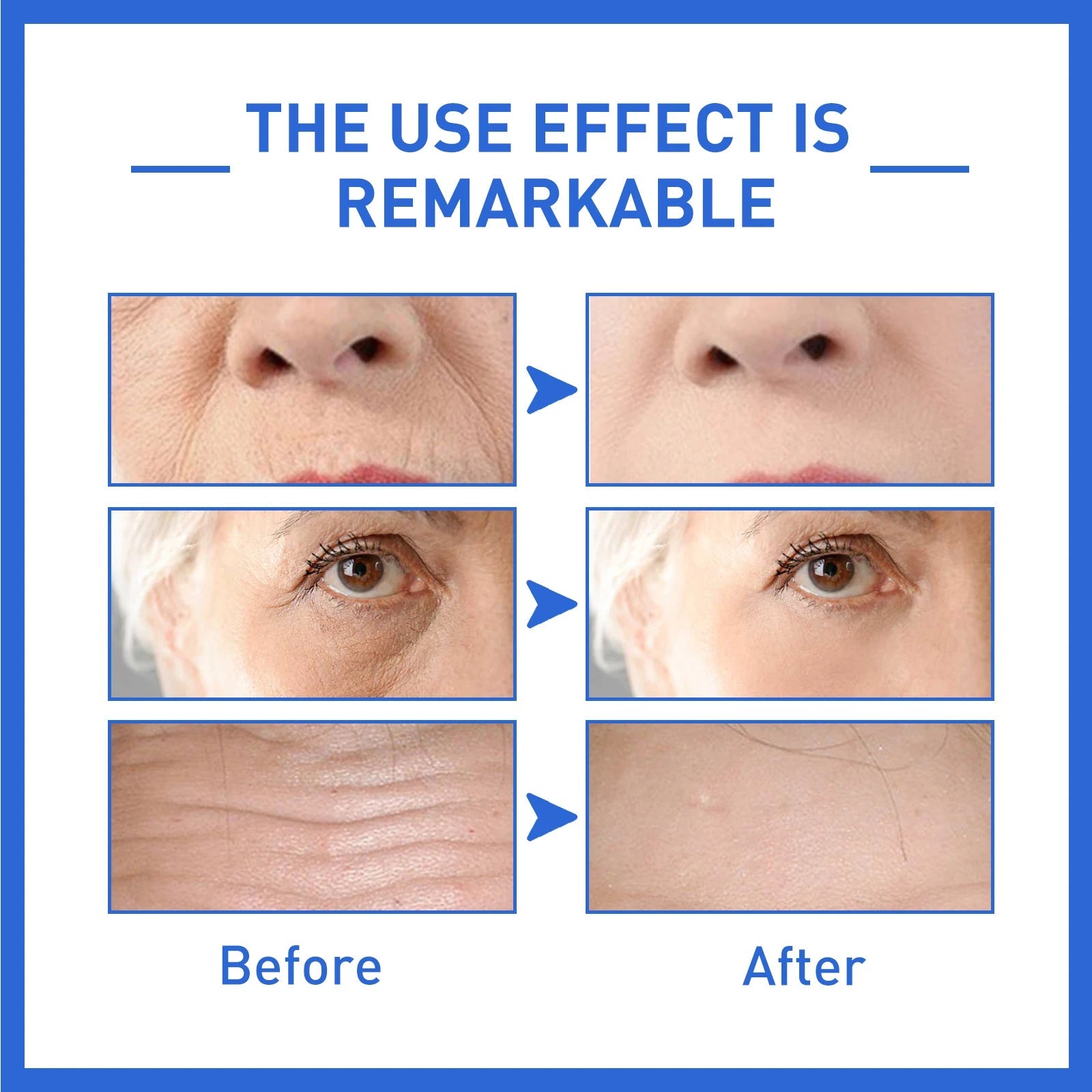Anti-Aging Collagen Serum with Nicotinamide, Vitamin C, Hyaluronic Acid - Reduce Dark Spots, Cleanse &amp; Tighten Skin