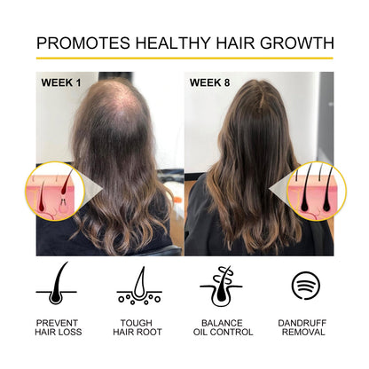 Dense Hair Essential Oil, Moisturize And Thicken Hair Repair Hair Root Damaged Hair Strong Firming Hair Care Essential Oil