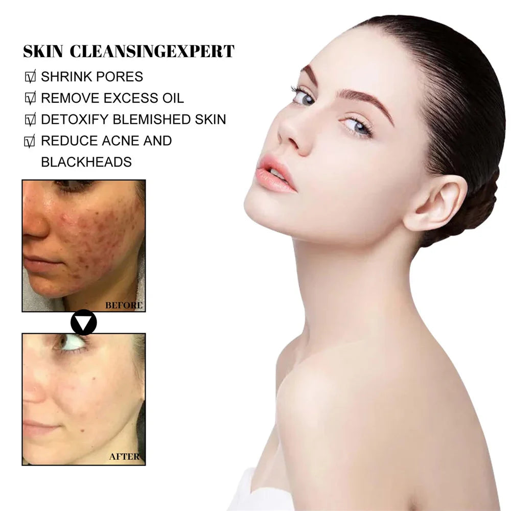 West &amp; Month Blackhead Remove Solid Mud Film Refreshing Skin Cleaning Face Mask Moisturize Control Oil Shrink Pores Skin Care