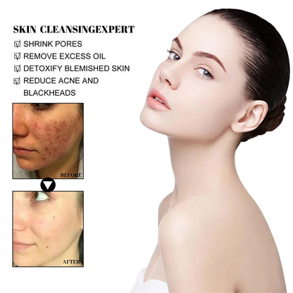 West &amp; Month Blackhead Remove Solid Mud Film Refreshing Skin Cleaning Face Mask Moisturize Control Oil Shrink Pores Skin Care
