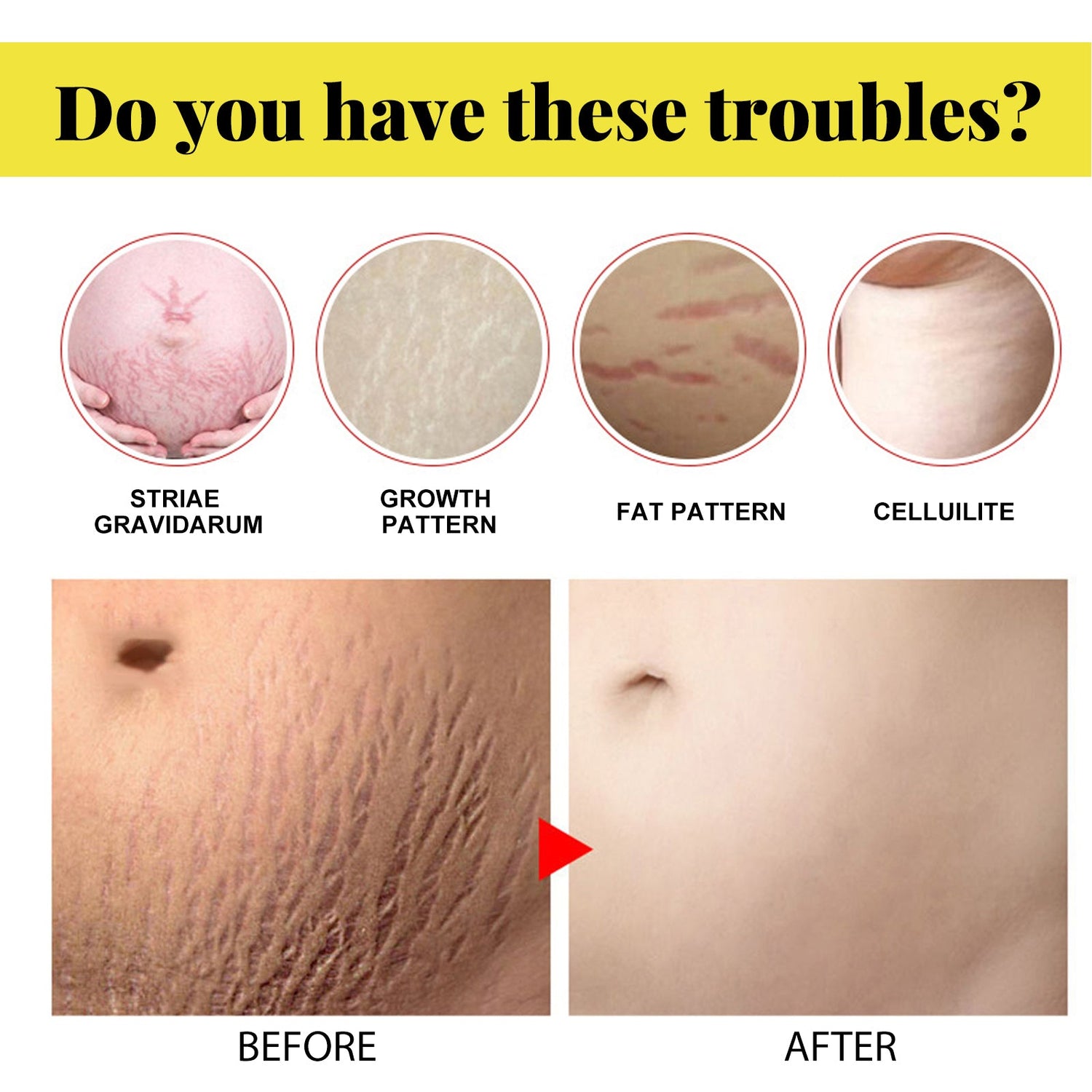 Skin Care Cream, Pregnant Women&