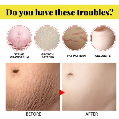 Skin Care Cream, Pregnant Women&