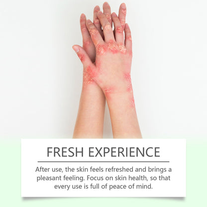 Herbal Skin Soothing Cream That Soothes And Nourishes Uncomfortable Skin With Body Skin Treatment Cream
