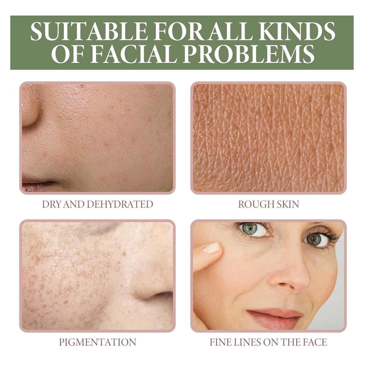 5% Niacinamide Serum, Chun White Tender Skin Fade Spots Brighten Moisturizing Skin Fine Pores