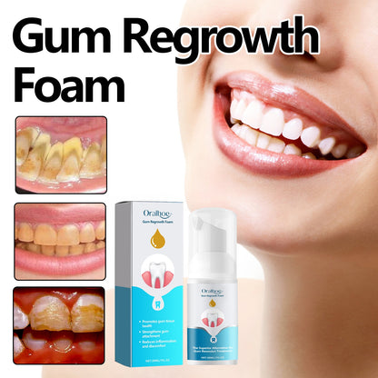 oralhoe Gum Regrowth Foam, Clean Teeth Tartar Care Gums Clean Teeth Anti-Moth Fresh Breath Mousse
