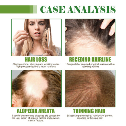 Hair Care Essential Oil Moisturizes And Protects Dry Hair, Moisturizes And Softens Hair Care Essential Oil