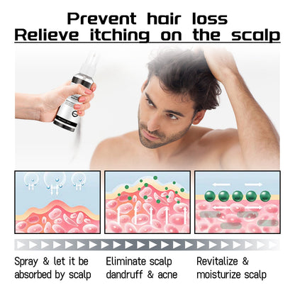 West &amp; Month Anti-Shedding Hair Spray, Improve The Hairline Hair Hair Nutrition Moisture Hair Roots
