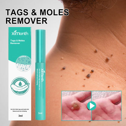 Keyu Liquid Repair Smooth Face Body Skin Deep Cleaning Moles Corns Keyu Liquid Pen