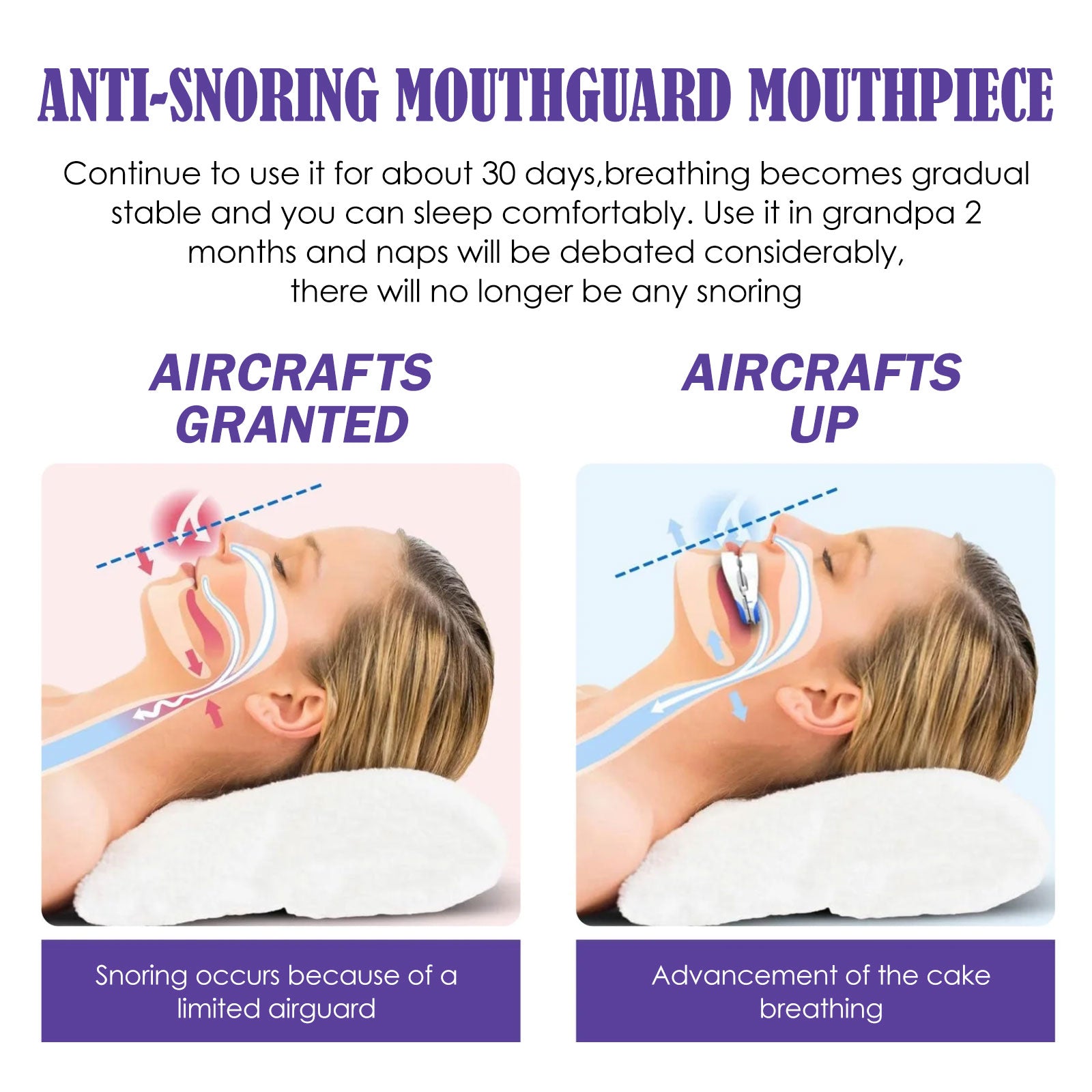 Anti-Grinding And Anti-Snoring Braces To Prevent Snoring Grinding Teeth At Night Mouthguard Protective Braces For Teeth