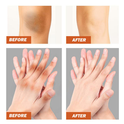 Black Wattle Essential Oil, Repair Underarm Joint Black Whitening Skin Light Spots Skin Beauty Essence Oil